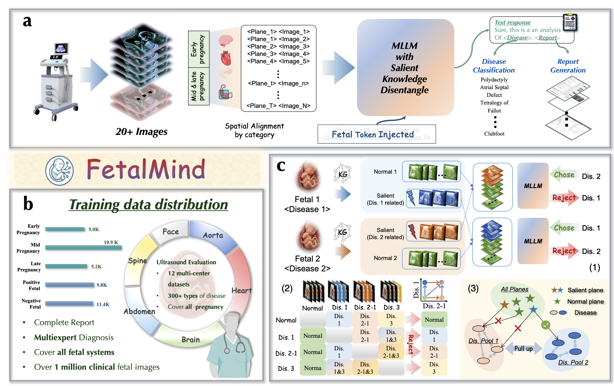 Overview of FetalMind, FetalSigma-1M, and salient epistemic disentanglement